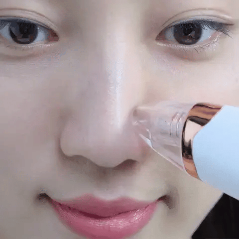 Electric Blackhead Remover – Pore Vacuum Suction & Deep Face Cleaner