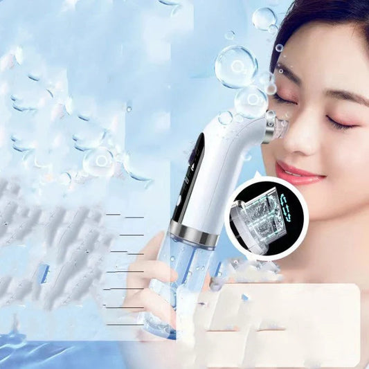 Electric Blackhead & Pore Vacuum Cleaner – Deep Pore Facial Cleanser